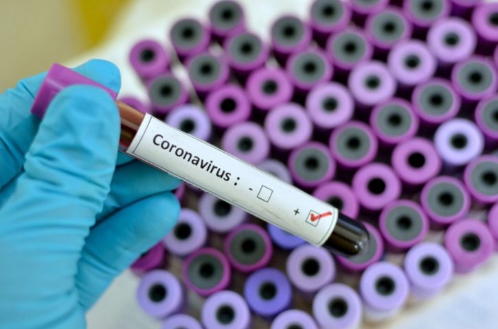 Informe diario de situación por coronavirus en Avellaneda